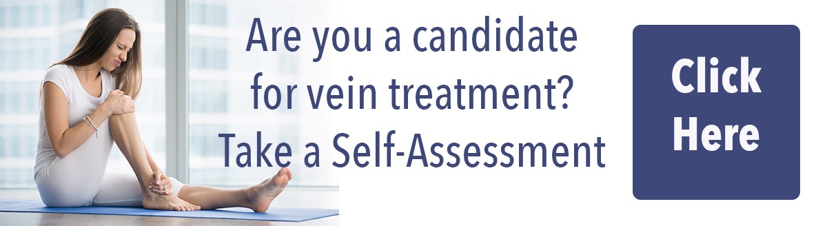 Varicose Vein Self Assessment Survey