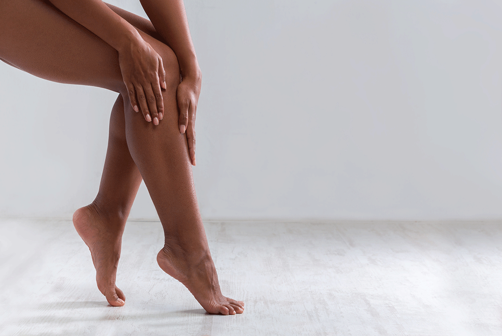 Varicose and Spider Veins: Myths and Misinformation