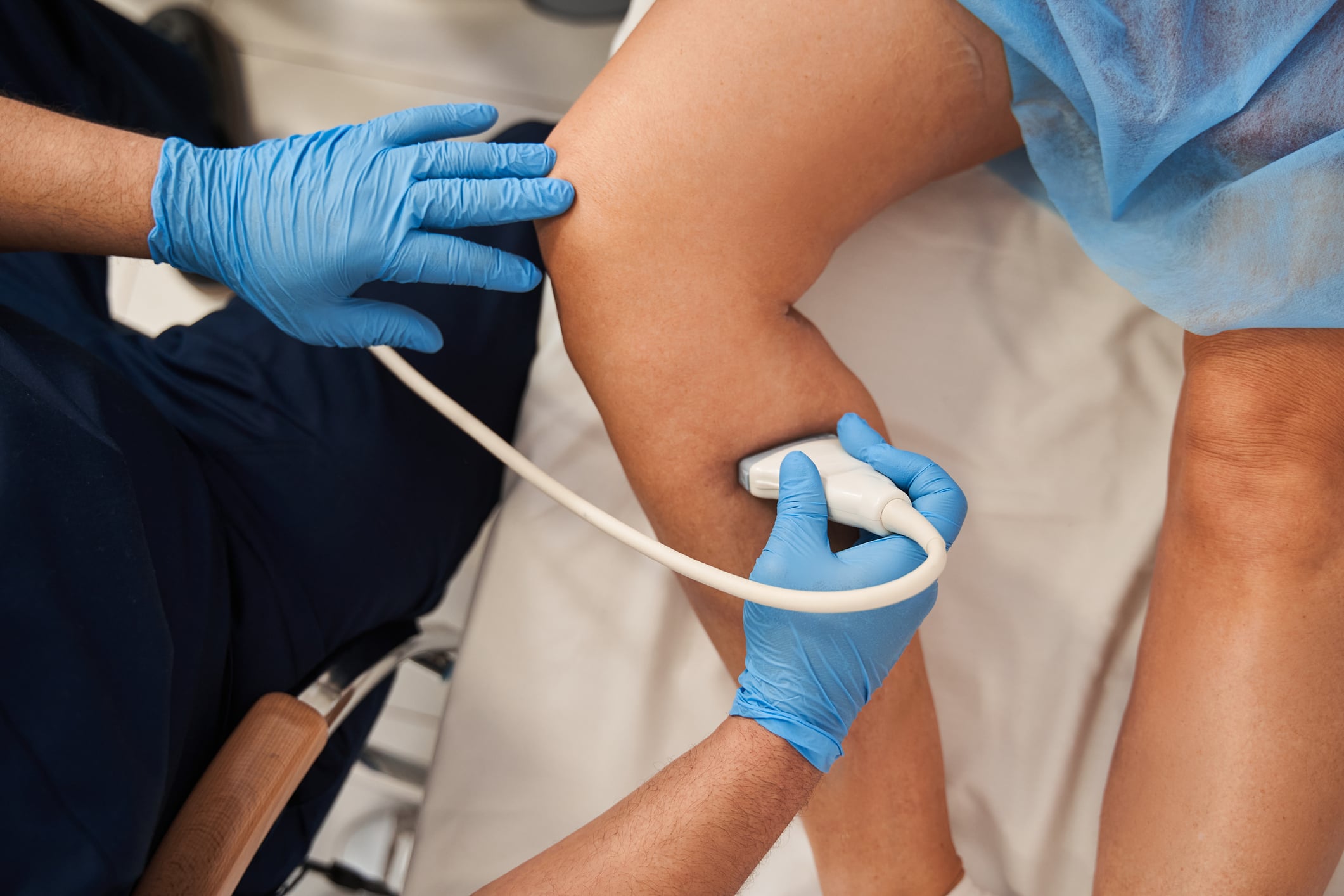 Do You Need an Ultrasound for Vein Problems?