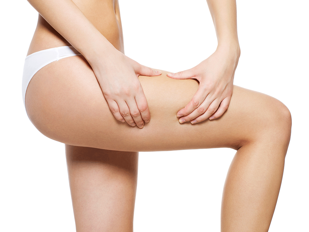 Do You Know the Difference Between Varicose, Spider, and Reticular Veins?